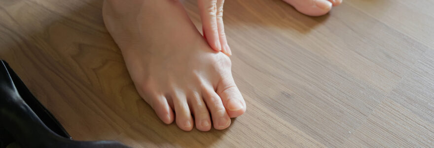 hallux valgus